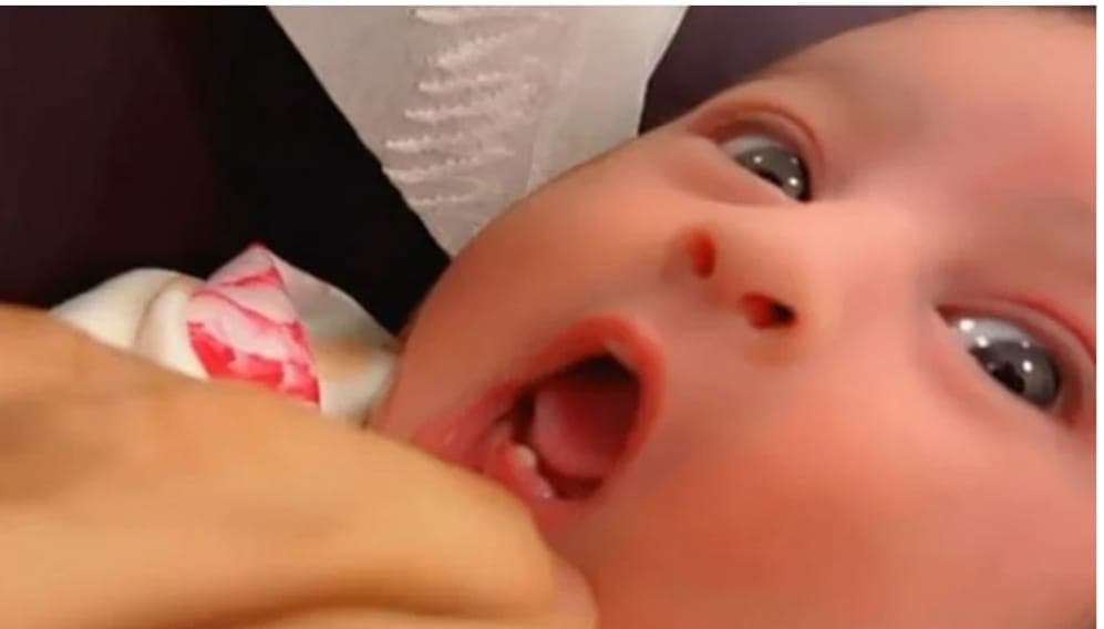 پیدائش کے 6دن بعد بچی کے دانت نکل آئے، ڈاکٹرز دنگ رہ گئے